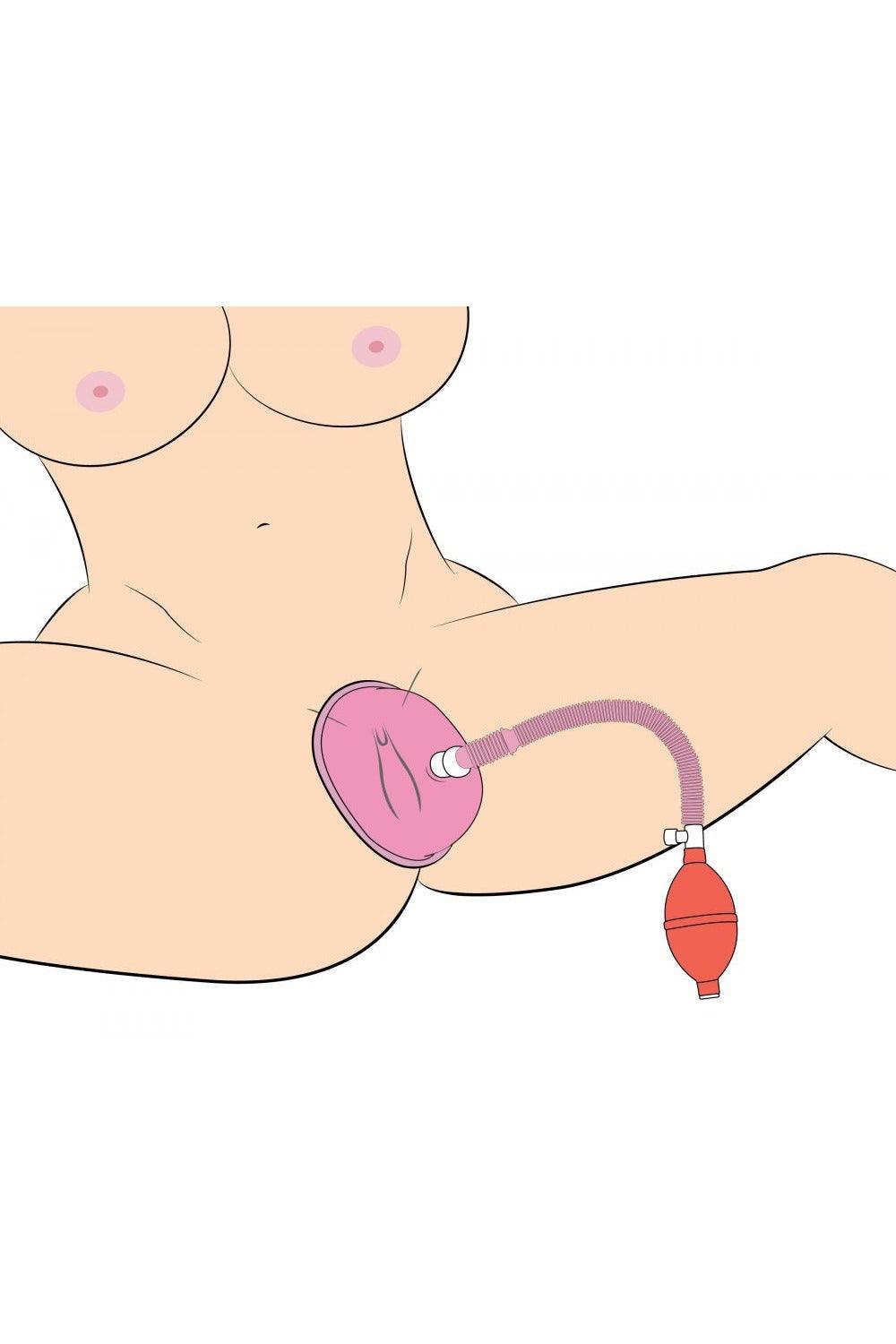 Vaginal Pump With 3.8 Inch Small Cup